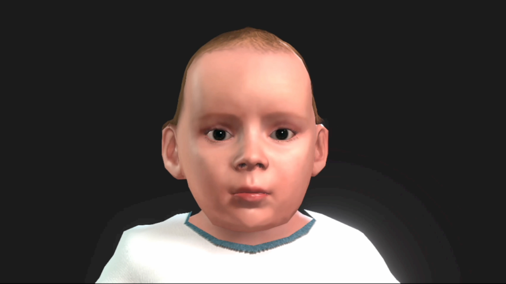 Photo du bébé présentant une anomalie de la forme du crâne issu du simulateur numérique : Culture du doute 1 l Module 1